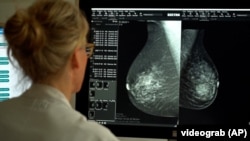 Лунд университетинин (Швеция) окумуштуулары аялдардын эмчек рагын аныктоо үчүн жасалма интеллектти колдонууну сунушташкан.