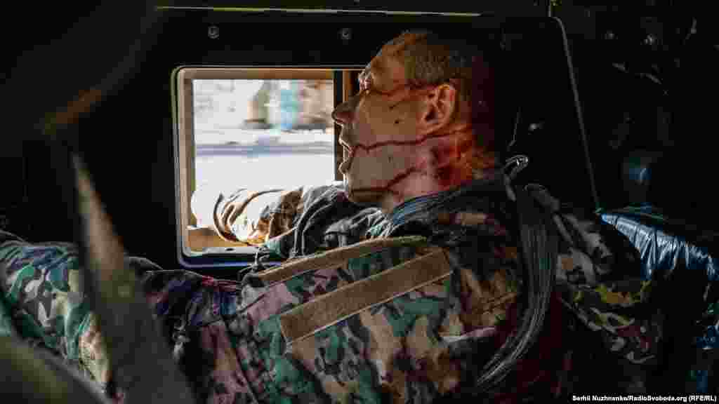 Поранений українській військовий під час евакуації з Сєвєродонецька