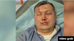 Эрнис Бердиев в больнице