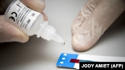 Тест на ВИЧ